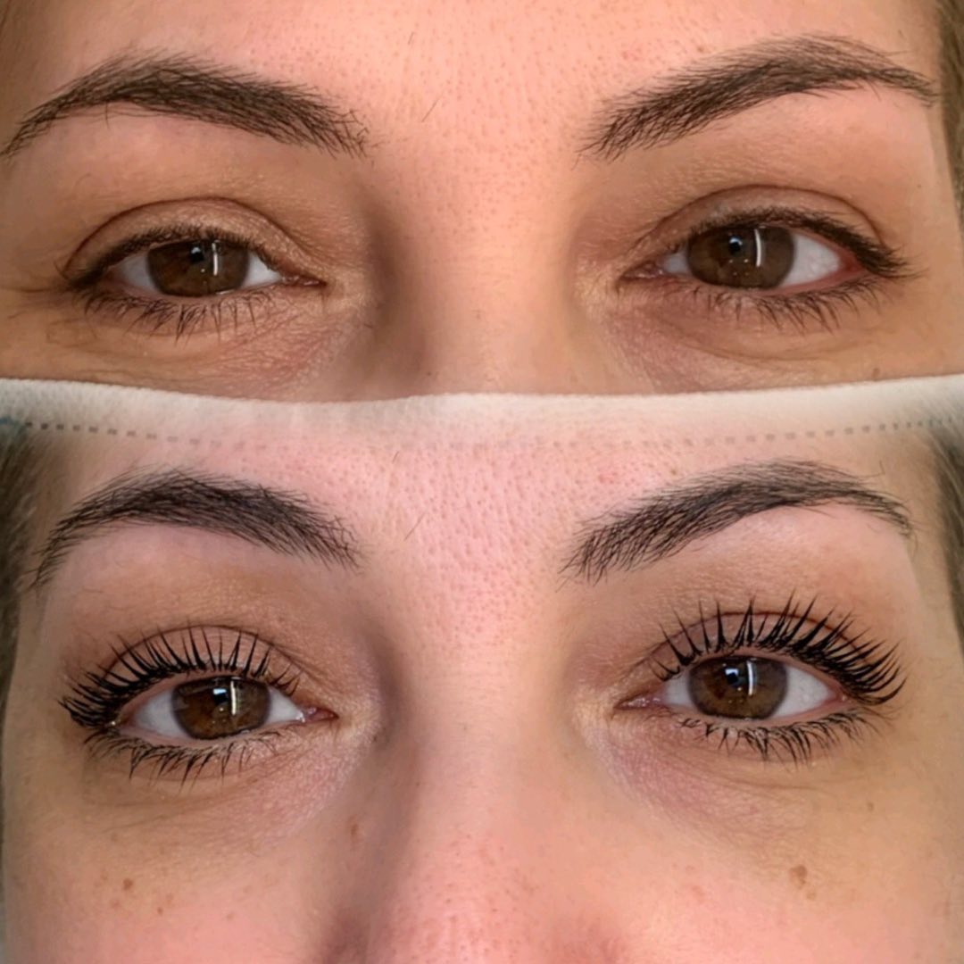 how long does eyelash lift last